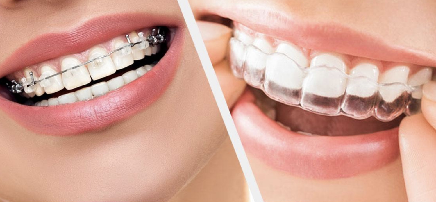 general-dentistry-vs-orthodontics